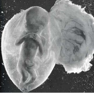 无痛人流与药流哪个更好?